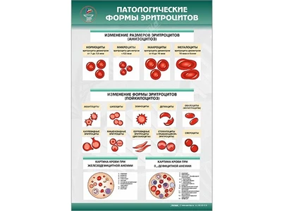 Информационный стенд "Патологические формы эритроцитов" Zarnitza 553584493