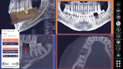 Программное обеспечениеМодуль Exocad DICOM viewer 1147787005