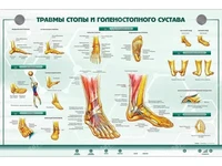 Интерактивный светодинамический стенд "Травмы стопы и голеностопного сустава" Zarnitza 754081004