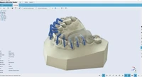 Программное обеспечение Maestro 3D Detal Studio | Ortho Studio 1531263662
