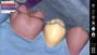 Модуль Exocad Provisional 1859059090