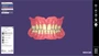 Программное обеспечение Exocad Full Denture Module 825012796